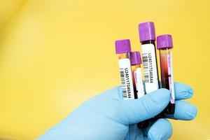 研究：新型血檢能篩出「早期階段癌症」