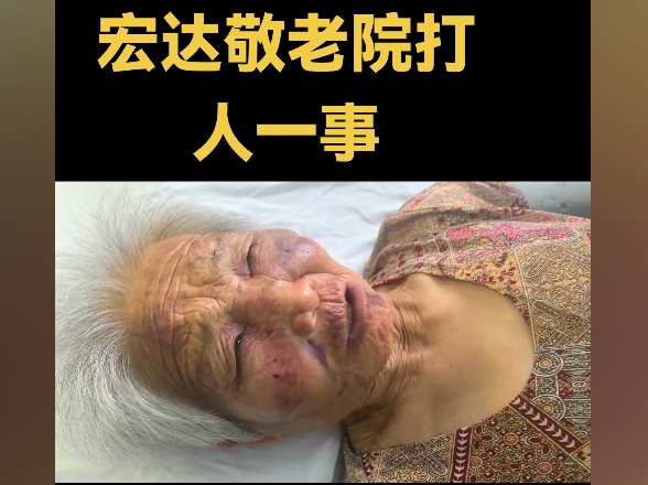山西運城85歲老人在養老院遭毆打 多處骨折
