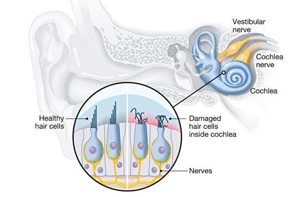失去的聽力還能恢復？研究提供新途徑