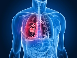 研究：Omicron變體對肺部的感染比Delta弱