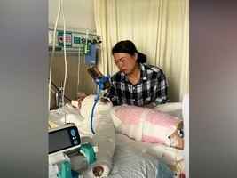 河南8歲女孩開燈引發煤氣爆炸 身體58%燒傷