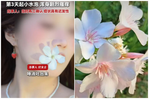 福建女生口含夾竹桃拍照 2天後現中毒反應