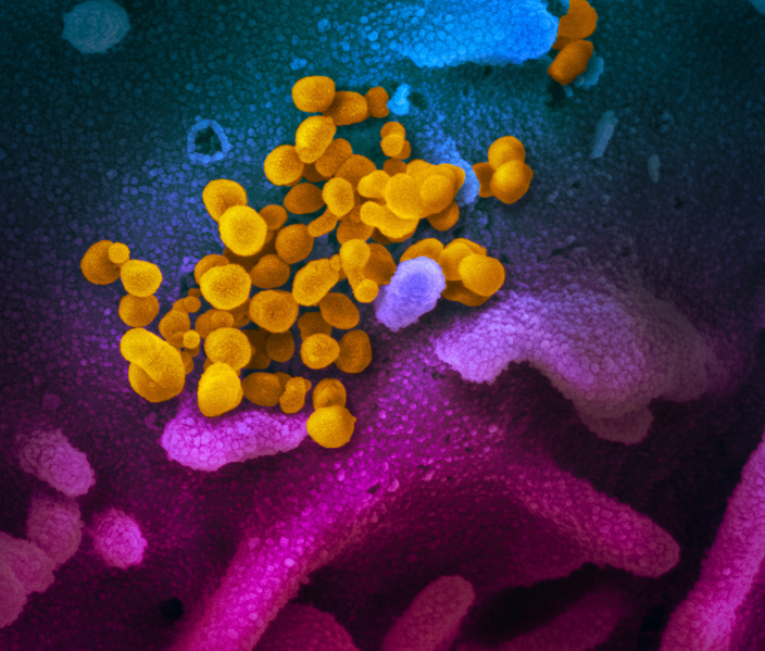 美國專家公佈在掃瞄式電子顯微鏡上觀察到的新型冠狀病毒影像。（NIAID flickr；NIAID-RML，CC BY 2.0）