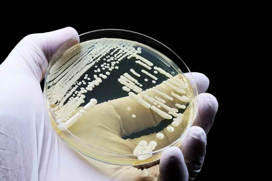 CDC警告 致命真菌耳念珠菌正威脅全球健康