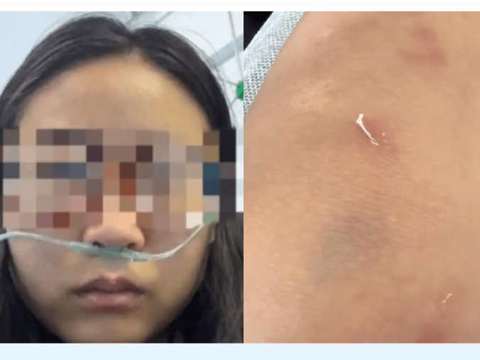 內蒙女子追薪 被老闆夫婦毆打半小時