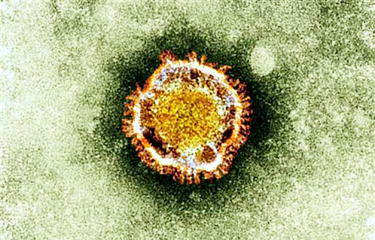 圖為英國健康保護機構拍到的中共病毒（俗稱武漢病毒、新冠病毒）在顯微鏡下的樣貌。（HO / BRITISH HEALTH PROTECTION AGENCY / AFP）