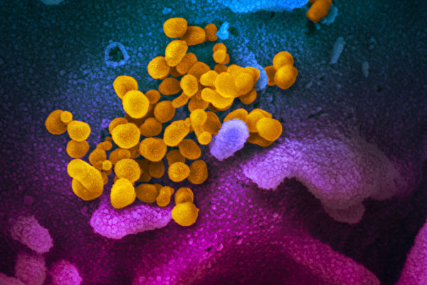 圖為美國專家近日公佈在掃瞄式電子顯微鏡上觀察到的新型冠狀病毒影像，病毒上黃色，細胞表面上藍色和粉紅色。（NIAID flickr；NIAID-RML，CC BY 2.0）