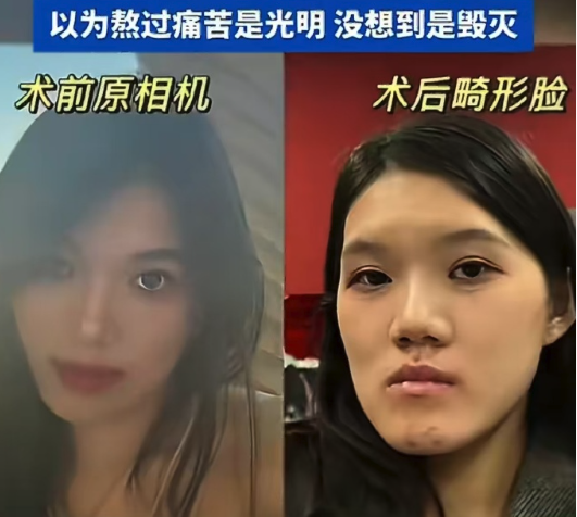 武漢24歲女做正顎手術 醫生反向操作致多重損傷
