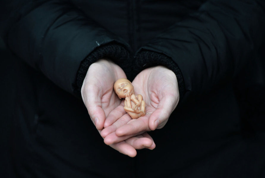【名家專欄】禁止人類胎兒養殖 防患於未然
