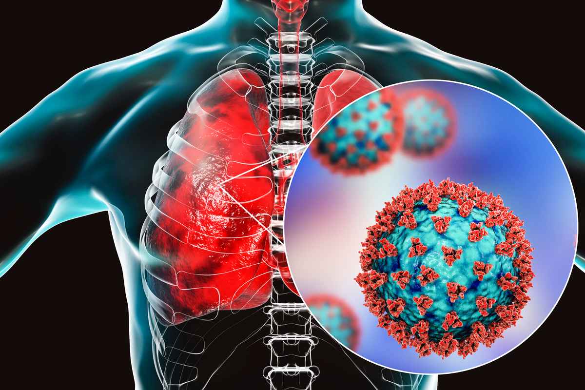 Covid-19病毒感染肺部細胞示意圖。（Shutterstock）