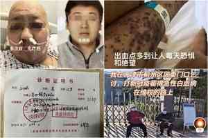 天津男子打疫苗後患白血病 死於「維穩病房」