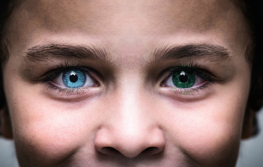 美國母子患罕見眼疾 瞳孔呈雙色異常美麗