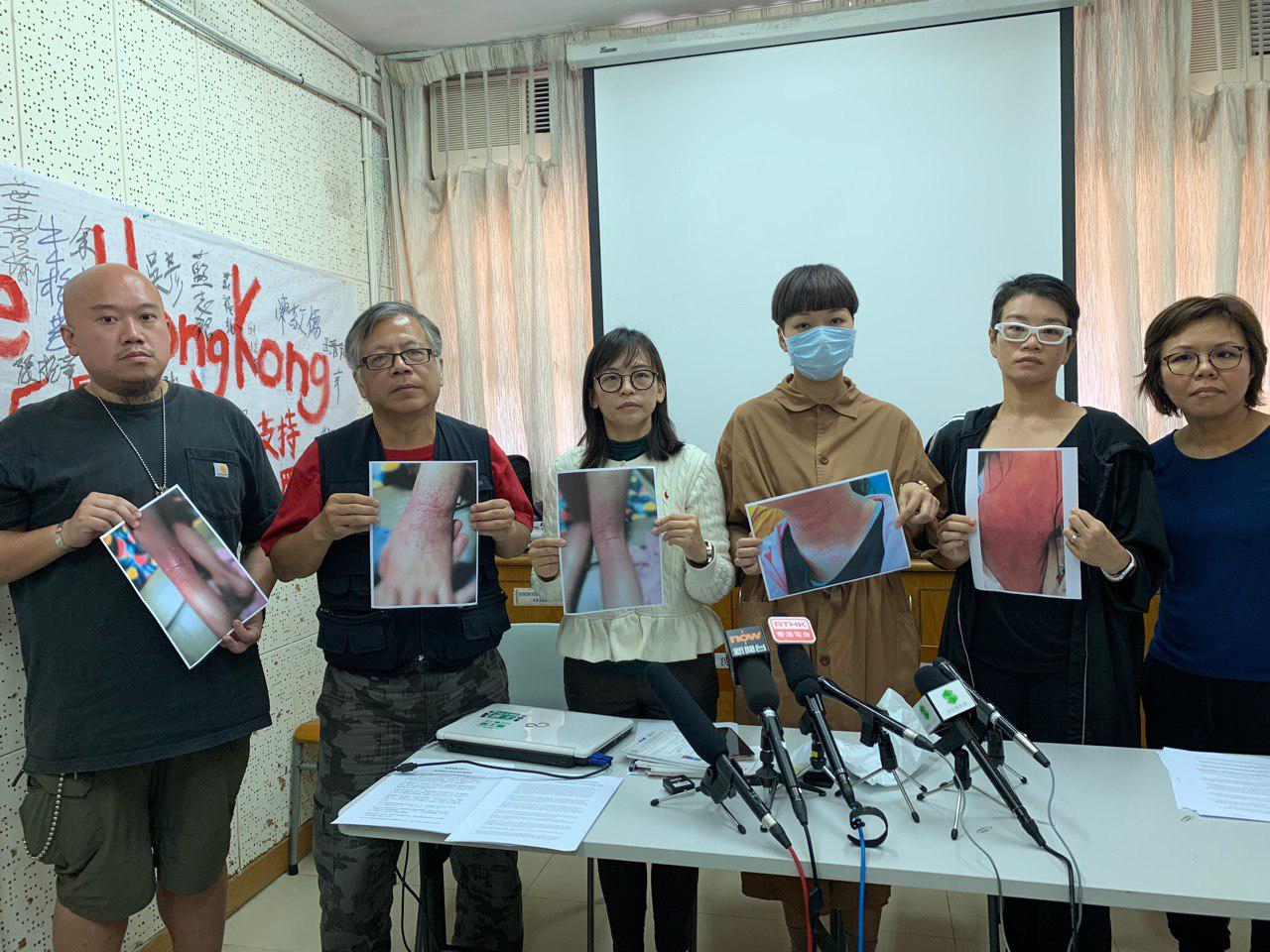 「香港媽媽反送中」11月27日舉辦記者會發佈調查結果：受催淚彈影響的兒童平均6歲，最小僅兩個月大。左二為K Kwong。（蔡溶／大紀元）