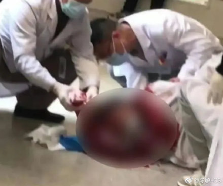 1月13日，武漢兒童醫院消化內科主任彭罕鳴遭一男子持刀砍傷。（網絡圖片）