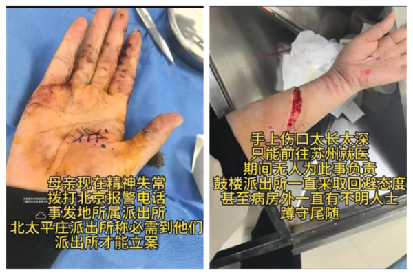 中共兩會 訪民被暴力維穩導致精神失常