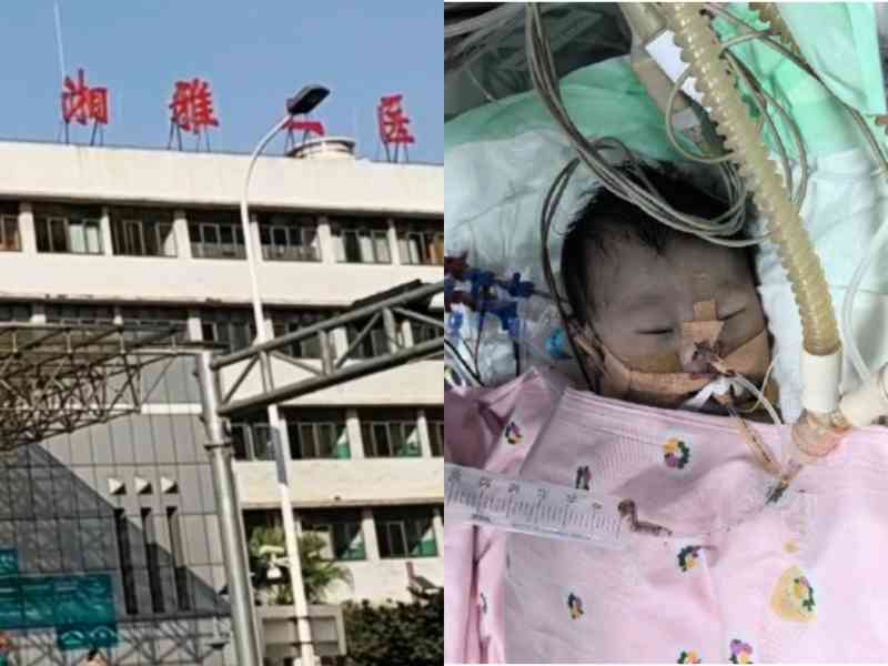 湘雅二院一新生兒兩次開胸手術後死亡
