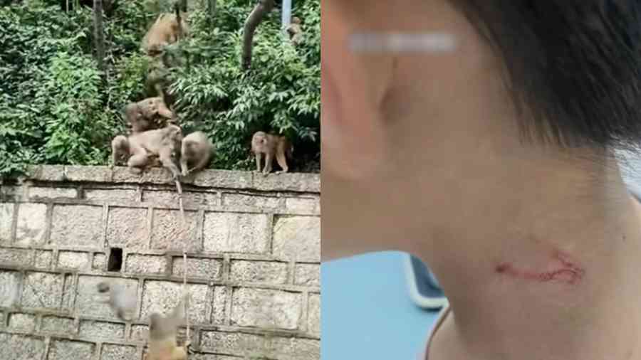 7歲男孩對小猴豎中指 遭猴群圍毆