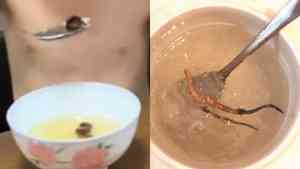 河南童被硬餵燕窩蟲草 2年瘦成皮包骨