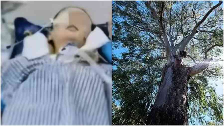 湖南女35層墮樓 歷經50天搶救奇蹟生還