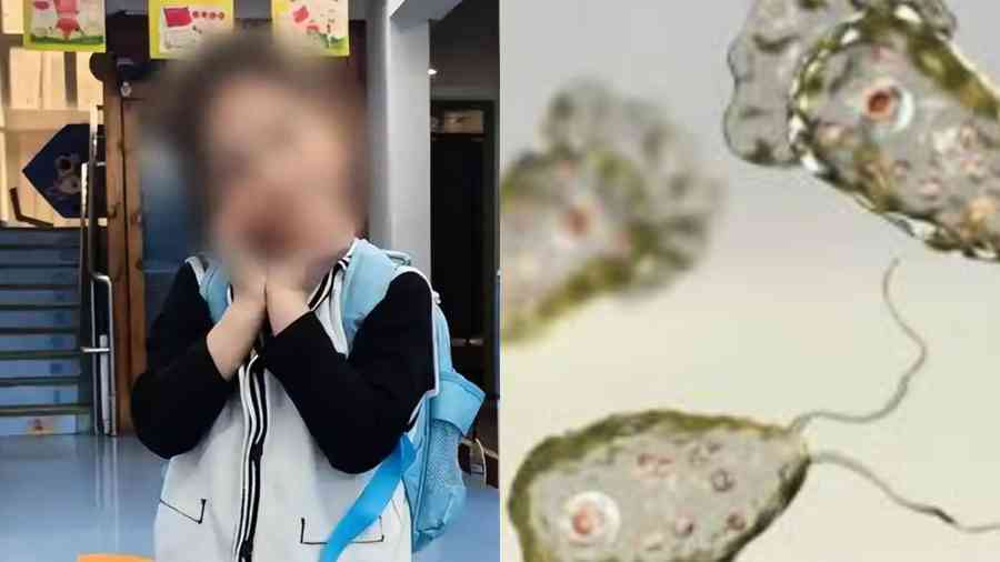 福建女童泡溫泉感染「食腦蟲」 搶救60天後去世