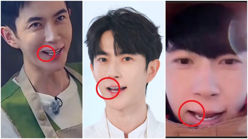 于朦朧死前數月被拔掉後槽牙？多段影片洩端倪