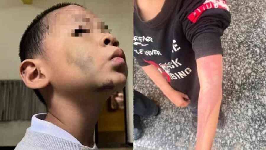 暴打燙下體逼吃大便 中國再爆繼母虐待幼兒慘案