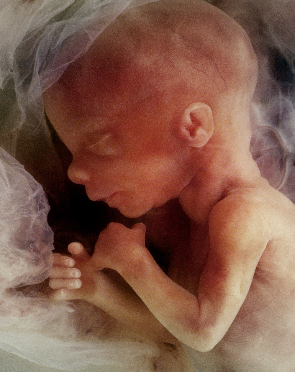 子宮內嬰兒的圖片。（Steve Allen/Shutterstock）